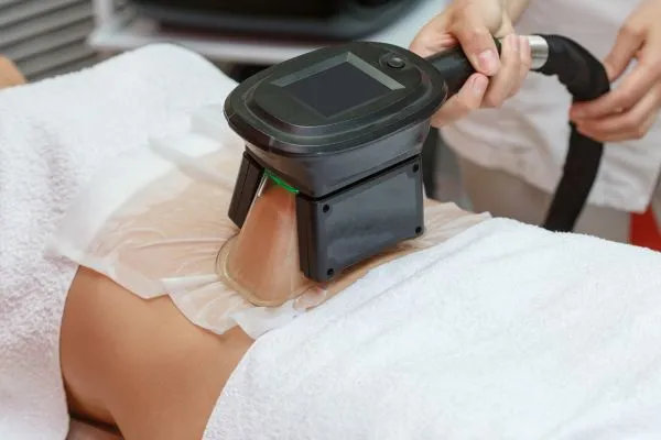 Image of person having fat freezing treatment to help weight gain Wembley