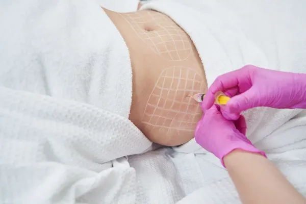 image of fat dissolving injections on love handles to help combat weight gain Wembley