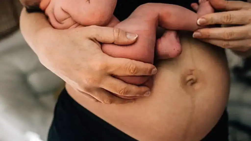 Why Is My Stomach Still Big After Pregnancy Wembley?